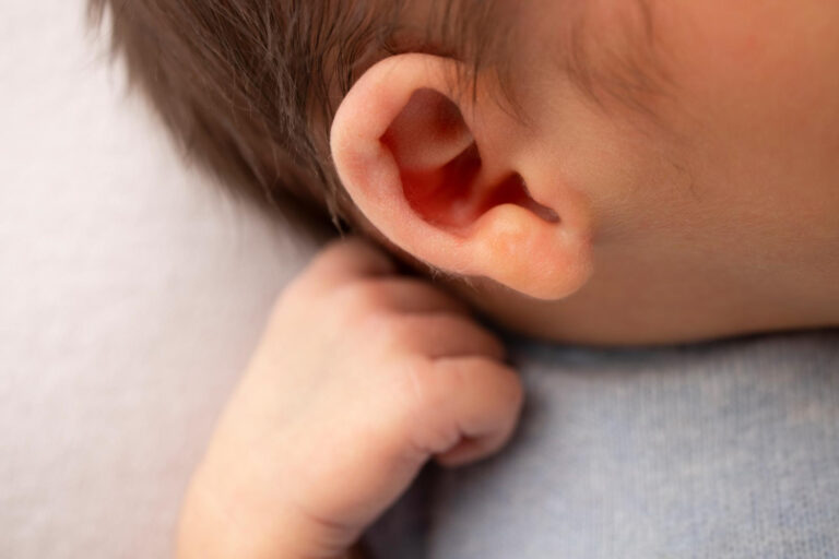My Newborn’s Ears Look Different, How Can I Tell If It Is Microtia or an Ear Deformity?